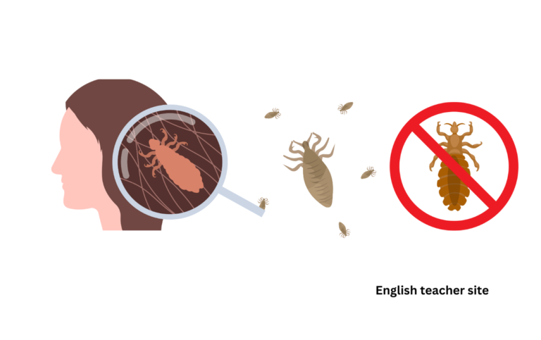 Is Lice Plural or Singular? Understanding the Term’s Grammatical Number